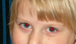 Red Eyes - 2 Les Yeux Rouges mt_popup:2 Les Yeux Rouges