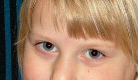 Red Eyes - 3 Correction mt_popup:3 Correction